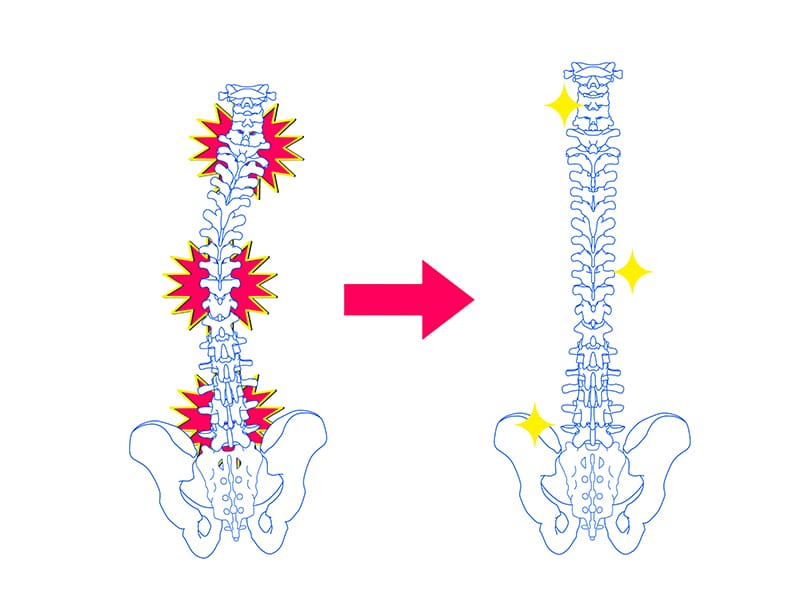 庵原崇カイロプラクティックオフィス 背骨を正しい位置に戻す